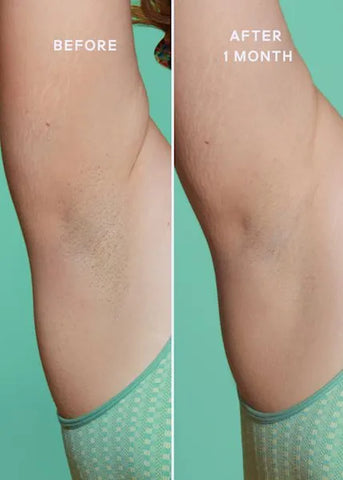 Ultimate Skin Solution