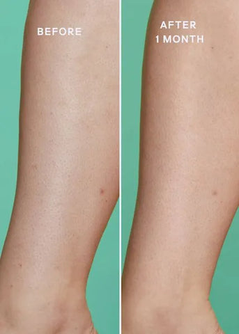 Ultimate Skin Solution